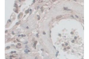 Immunohistochemistry (IHC) image for anti-NADPH Oxidase 5 (NOX5) (AA 456-765) antibody (ABIN7444193)