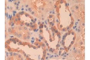 Immunohistochemistry (IHC) image for anti-Pyruvate Kinase, Liver and RBC (PKLR) (AA 219-420) antibody (ABIN7431302)