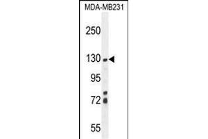 ZSWIM6 Antibody (C-term) (ABIN654590 and ABIN2844290) western blot analysis in MDA-M cell line lysates (35 μg/lane). (ZSWIM6 抗体  (C-Term))
