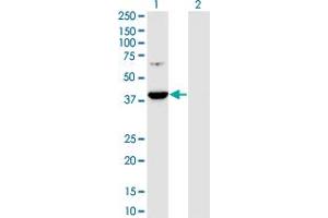 Western Blot analysis of PRPSAP1 expression in transfected 293T cell line by PRPSAP1 monoclonal antibody (M01), clone 5H10.