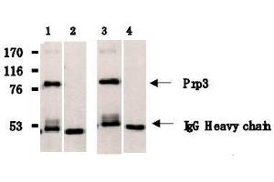 Western Blotting (WB) image for anti-PRP3 Pre-mRNA Processing Factor 3 Homolog (PRPF3) antibody (ABIN1449201) (PRPF3 抗体)