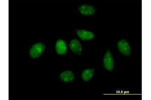 Immunofluorescence of purified MaxPab antibody to PLK1 on HeLa cell. (PLK1 抗体  (AA 1-603))