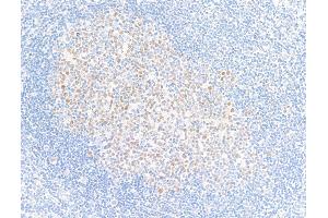 Immunohistochemistry (IHC) image for anti-B-Cell CLL/lymphoma 6 (BCL6) (AA 375-425) antibody (ABIN7455109)