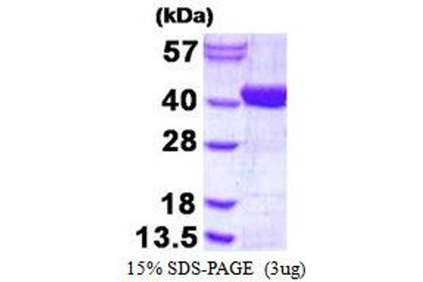 ADPRHL2 Protein (His tag)
