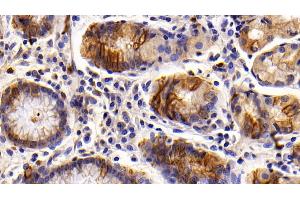 Detection of KRT6A in Human Stomach Tissue using Polyclonal Antibody to Keratin 6A (KRT6A) (KRT6A 抗体  (AA 163-468))