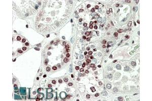 ABIN1590011 (5µg/ml) staining of paraffin embedded Human Kidney.