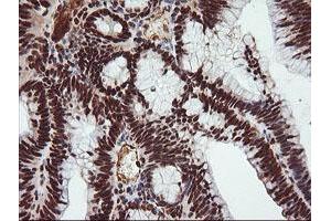 Image no. 10 for anti-Tripartite Motif Containing 38 (TRIM38) (AA 1-265) antibody (ABIN1490681)