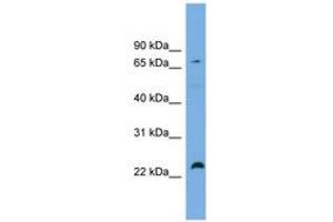 Image no. 1 for anti-Spastic Paraplegia 20 (Troyer Syndrome) (SPG20) (AA 431-480) antibody (ABIN6743807) (SPG20 抗体  (AA 431-480))