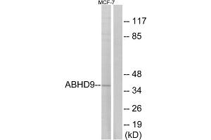 Western blot analysis of extracts from MCF-7 cells, using ABHD9 antibody. (ABHD9 抗体  (Internal Region))