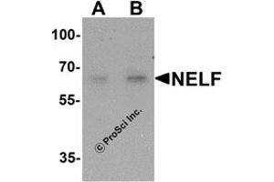 Western Blotting (WB) image for anti-NMDA Receptor Synaptonuclear Signaling and Neuronal Migration Factor (NSMF) antibody (ABIN1077438) (NMDA Receptor Synaptonuclear Signaling and Neuronal Migration Factor (NSMF) 抗体)