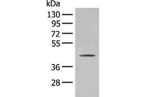 Western blot analysis of A375 cell lysate using OLA1 Polyclonal Antibody at dilution of 1:400 (OLA1 抗体)