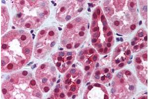 Human Kidney (formalin-fixed, paraffin-embedded) stained with DNMT1 antibody ABIN290479 at 2. (DNMT1 抗体  (AA 177-550))