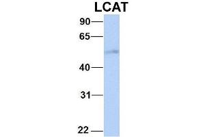 Western Blotting (WB) image for anti-Lecithin-Cholesterol Acyltransferase (LCAT) (C-Term) antibody (ABIN2776942)