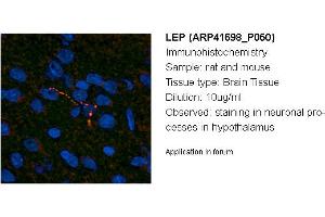 Image no. 1 for anti-Leptin (LEP) (Middle Region) antibody (ABIN2776944) (Leptin 抗体  (Middle Region))