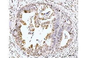 IHC analysis of MSK2/RSK-B/RPS6KA4 using anti-MSK2/RSK-B/RPS6KA4 antibody (ABIN7601238).