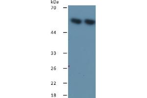 Rabbit Detection antibody from the kit in WB with Positive Control: Sample Lane1: Human A549 Cells; Lane2: Human MCF-7 Cells. (HSPD1 ELISA 试剂盒)