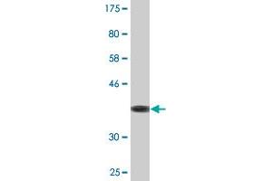 Western Blotting (WB) image for anti-Z-DNA Binding Protein 1 (ZBP1) (AA 2-100) antibody (ABIN529332)