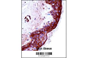 KLK9 Antibody immunohistochemistry analysis in formalin fixed and paraffin embedded human skin tissue followed by peroxidase conjugation of the secondary antibody and DAB staining. (Kallikrein 9 抗体  (AA 82-111))