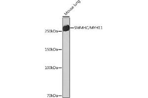 Western blot analysis of extracts of Mouse lung, using SMMHC/SMMHC/MYH11 Rabbit mAb (ABIN7268745) at 1:1000 dilution. (MYH11 抗体)