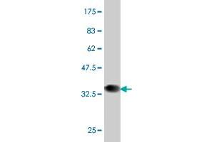 Western Blot detection against Immunogen (37. (PBX1 抗体  (AA 213-321))