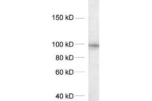 dilution: 1 : 1000, sample: crude synaptosomal fraction of rat brain (P2) (DLG2 抗体  (AA 22-37))