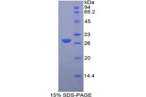 SDS-PAGE analysis of Mouse LOXL3 Protein. (LOXL3 蛋白)