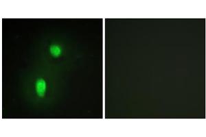 Immunofluorescence analysis of HUVEC cells, using hnRNP C1/C2 antibody. (HNRNPC 抗体  (C-Term))