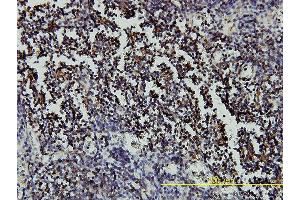 Immunoperoxidase of monoclonal antibody to RARA on formalin-fixed paraffin-embedded human lymph node tissue. (Retinoic Acid Receptor alpha 抗体  (AA 1-462))
