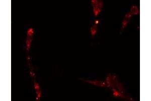 ABIN6275052 staining  A549 cells by IF/ICC. (APPL1 抗体  (Internal Region))