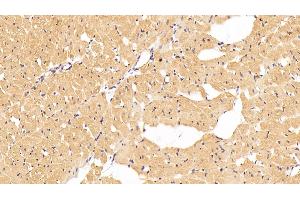 Immunohistochemistry (IHC) image for anti-Angiopoietin-Like 4 (ANGPTL4) (AA 182-388) antibody (ABIN7433018)