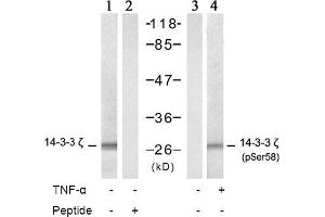 Image no. 2 for anti-14-3-3 zeta (YWHAZ) (pSer58) antibody (ABIN196916) (14-3-3 zeta 抗体  (pSer58))