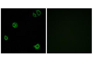 Immunofluorescence analysis of A549 cells, using GPR110 antibody. (G Protein-Coupled Receptor 110 抗体  (C-Term))