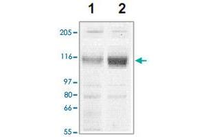 The tissue lysates derived from mouse heart (lane 1) or rat heart (lane 2) were immunoprobed by Corin polyclonal antibody  at 1 : 500. (Corin 抗体  (C-Term))