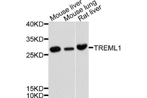 Western blot analysis of extracts of various cell lines, using TREML1 antibody (ABIN4905487) at 1:1000 dilution. (TREML1 抗体)