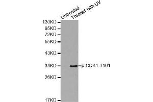 Western blot analysis of extracts from Hela cells using Phospho-CDK1-T161 antibody. (CDK1 抗体  (pThr161))