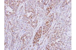 IHC-P Image Immunohistochemical analysis of paraffin-embedded A549 xenograft, using RPS10, antibody at 1:500 dilution. (RPS10 抗体)