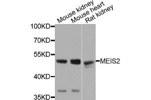 Western blot analysis of extracts of various cell lines, using MEIS2 antibody. (MEIS2 抗体)