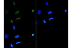 Immunofluorescence of Rabbit Anti-Histone H3 [ac Lys18] Antibody. (Histone 3 抗体  (H3K18ac))