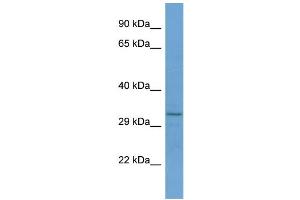 Host:  Rabbit  Target Name:  RNF150  Sample Type:  Jurkat Whole cell lysates  Antibody Dilution:  1. (RNF150 抗体  (C-Term))