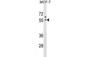 Western Blotting (WB) image for anti-Golgi Reassembly Stacking Protein 1, 65kDa (GORASP1) antibody (ABIN2999862) (GORASP1 抗体)