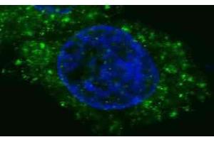 Immunofluorescence (IF) image for anti-Met Proto-Oncogene (MET) antibody (ABIN2995277) (c-MET 抗体)