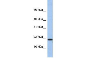 C1D antibody used at 0. (C1D 抗体  (N-Term))