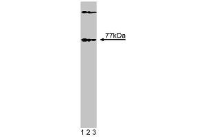Western blot analysis of Btk on EB1 lysate. (BTK 抗体  (N-Term))