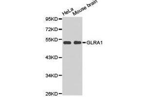Western Blotting (WB) image for anti-Glycine Receptor, alpha 1 (GLRA1) antibody (ABIN1872831) (GLRA1 抗体)