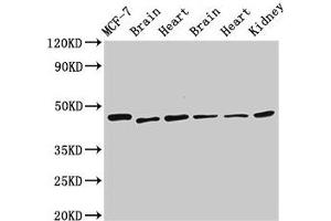 Western Blot Positive WB detected in: MCF-7 whole cell lysate, Rat brain tissue, Rat heart tissue, Mouse brain tissue, Mouse heart tissue, Mouse kidney tissue All lanes: DKC1 antibody at 2. (DKC1 抗体  (AA 94-170))