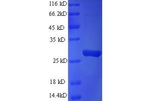 SDS-PAGE (SDS) image for RAB3A Interacting Protein (Rabin3)-Like 1 (RAB3IL1) (AA 21-247) protein (His tag) (ABIN5709635)