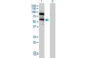 Western Blot analysis of DDX41 expression in transfected 293T cell line by DDX41 monoclonal antibody (M01), clone 2F4. (DDX41 抗体  (AA 523-622))