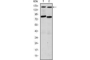 Western blot analysis using AIB1 mouse mAb against T47D (1) and MCF-7 (2) cell lysate. (NCOA3 抗体)