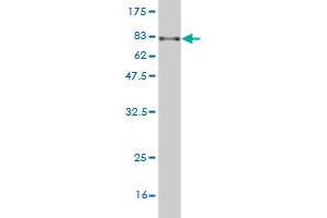 Western Blot detection against Immunogen (82. (ARHGEF5 抗体  (AA 1-519))