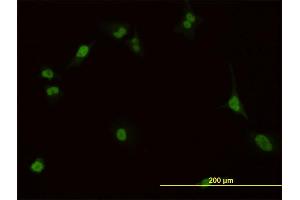 Immunofluorescence of monoclonal antibody to PBX1 on HeLa cell. (PBX1 抗体  (AA 213-321))